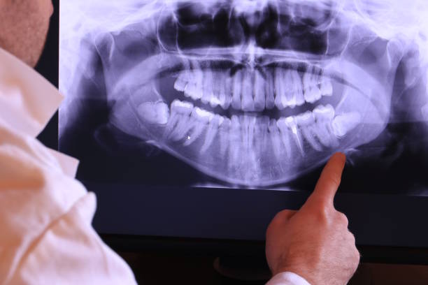 Best Emergency Root Canal Treatment in Perry, FL